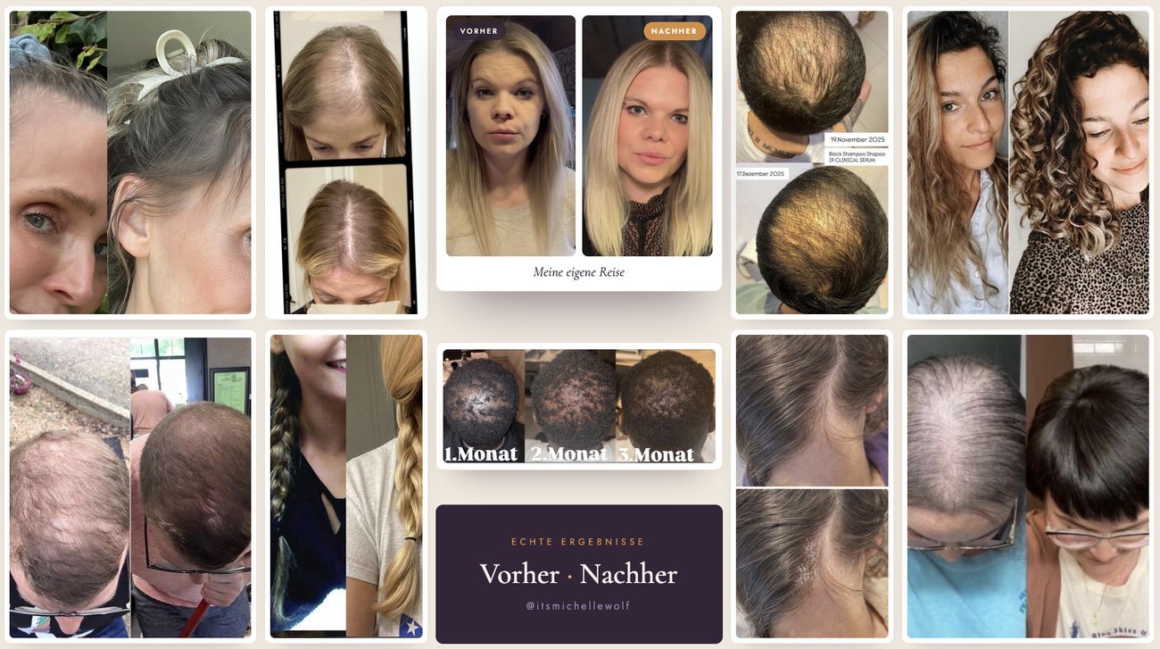 Vorher-Nachher-Ergebnisse aus der Community
